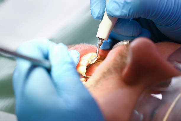 Best Chipped Tooth Repair Near Me  in Jackson, TN